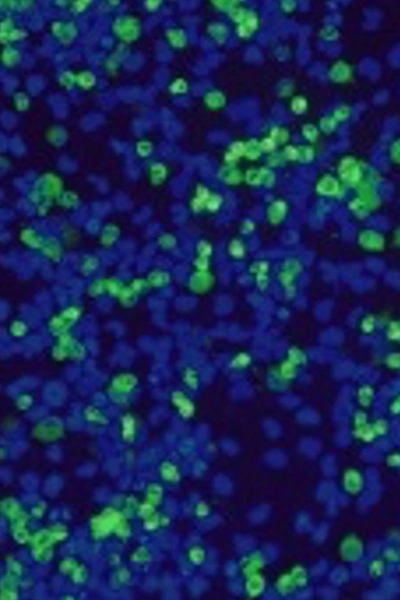 Molecular Pathogenesis 1